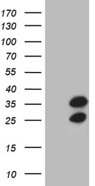 HEK293T cells were transfected with the pCMV6-ENTRY control (Left lane) or pCMV6-ENTRY RPL10A (, Right lane) cDNA for 48 hrs and lysed. Equivalent amounts of cell lysates (5 ug per lane) were separated by SDS-PAGE and immunoblotted with anti-RPL10A (1:2000). 