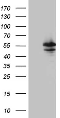 HEK293T cells were transfected with the pCMV6-ENTRY control (Left lane) or pCMV6-ENTRY MYOT (, Right lane) cDNA for 48 hrs and lysed. Equivalent amounts of cell lysates (5 ug per lane) were separated by SDS-PAGE and immunoblotted with anti-MYOT (1:2000). 