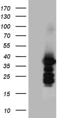 HEK293T cells were transfected with the pCMV6-ENTRY control ( Left lane) or pCMV6-ENTRY ZCCHC17 ( Right lane) cDNA for 48 hrs and lysed. Equivalent amounts of cell lysates (5 ug per lane) were separated by SDS-PAGE and immunoblotted with anti-ZCCHC17 (1:500). Positive lysates