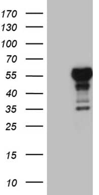 HEK293T cells were transfected with the pCMV6-ENTRY control ( Left lane) or pCMV6-ENTRY LHX4 ( Right lane) cDNA for 48 hrs and lysed. Equivalent amounts of cell lysates (5 ug per lane) were separated by SDS-PAGE and immunoblotted with anti-LHX4 (1:2000). Positive lysates
