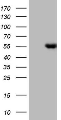 HEK293T cells were transfected with the pCMV6-ENTRY control (Left lane) or pCMV6-ENTRY LHX4 (, Right lane) cDNA for 48 hrs and lysed. Equivalent amounts of cell lysates (5 ug per lane) were separated by SDS-PAGE and immunoblotted with anti-LHX4 (1:2000). 