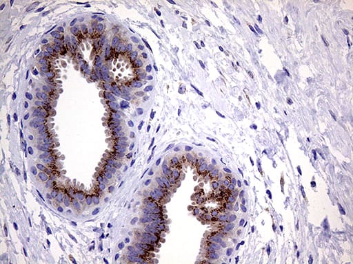Immunohistochemical staining of paraffin-embedded Human breast tissue within the normal limits using anti-MYOT mouse monoclonal antibody. Heat-induced epitope retrieval by EDTA solution buffer pH 8.0 at 120Â°C for 3 min.