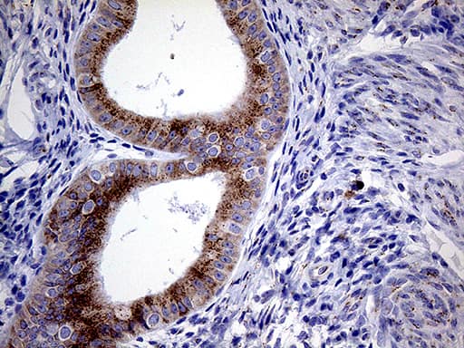 Immunohistochemical staining of paraffin-embedded Human endometrium tissue within the normal limits using anti-MYOT mouse monoclonal antibody. Heat-induced epitope retrieval by EDTA solution buffer pH 8.0 at 120Â°C for 3 min.