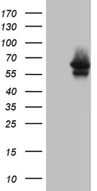HEK293T cells were transfected with the pCMV6-ENTRY control ( Left lane) or pCMV6-ENTRY MYOT ( Right lane) cDNA for 48 hrs and lysed. Equivalent amounts of cell lysates (5 ug per lane) were separated by SDS-PAGE and immunoblotted with anti-MYOT (1:2000). Positive lysates