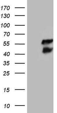 HEK293T cells were transfected with the pCMV6-ENTRY control (Left lane) or pCMV6-ENTRY BCL7B (, Right lane) cDNA for 48 hrs and lysed. Equivalent amounts of cell lysates (5 ug per lane) were separated by SDS-PAGE and immunoblotted with anti-BCL7B (1:2000). 