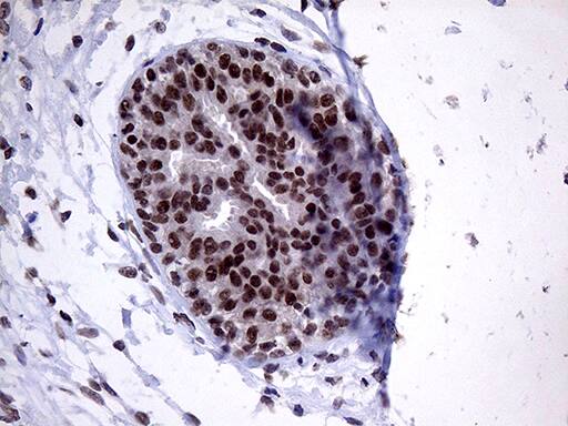 Immunohistochemical staining of paraffin-embedded Human breast tissue within the normal limits using anti-ZNF329 mouse monoclonal antibody. Heat-induced epitope retrieval by EDTA solution buffer pH 8.0 at 120Â°C for 3 min.