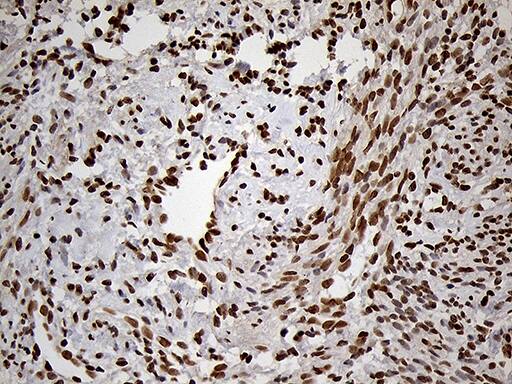 Immunohistochemistry:MEIS1 Antibody (OTI3G8)[NBP3-44990]