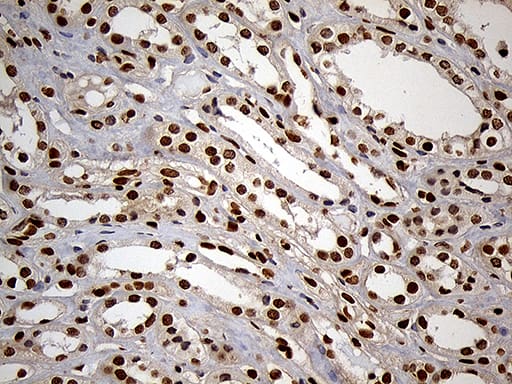 Immunohistochemical staining of paraffin-embedded Human Kidney tissue within the normal limits using anti-MEIS1 mouse monoclonal antibody. Heat-induced epitope retrieval by EDTA solution buffer pH 8.0 at 120Â°C for 3 min.