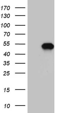 HEK293T cells were transfected with the pCMV6-ENTRY control (Left lane) or pCMV6-ENTRY MEIS1 (, Right lane) cDNA for 48 hrs and lysed. Equivalent amounts of cell lysates (5 ug per lane) were separated by SDS-PAGE and immunoblotted with anti-MEIS1 (1:2000).