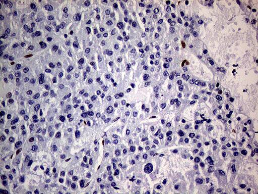 Immunohistochemistry:MEIS1 Antibody (OTI2A3)[NBP3-44991]