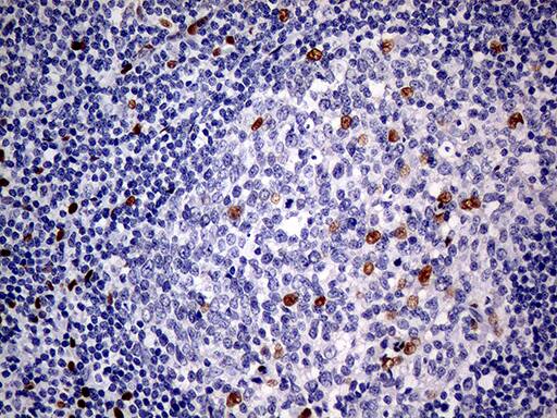 Immunohistochemistry:MEIS1 Antibody (OTI2A3)[NBP3-44991]
