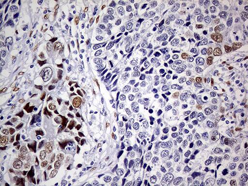 Immunohistochemistry:MEIS1 Antibody (OTI2A3)[NBP3-44991]