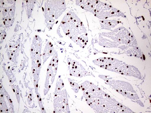 Immunohistochemistry:MEIS1 Antibody (OTI2A3)[NBP3-44991]