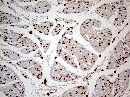 Immunohistochemistry:MEIS1 Antibody (OTI3H2)[NBP3-44994]