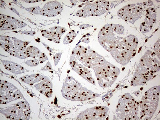 Immunohistochemical staining of paraffin-embedded Human bladder tissue within the normal limits using anti-MEIS1 mouse monoclonal antibody. Heat-induced epitope retrieval by EDTA solution buffer pH 8.0 at 120Â°C for 3 min.