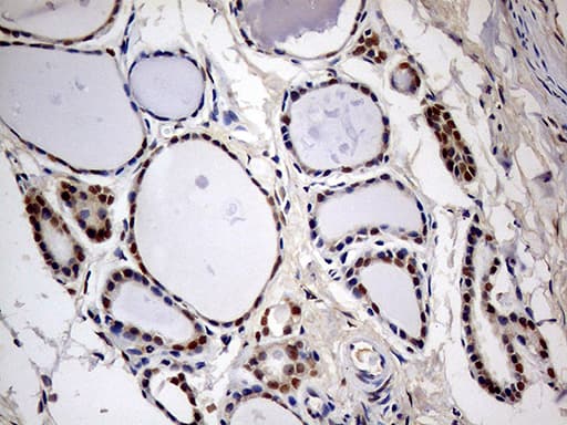 Immunohistochemical staining of paraffin-embedded Human thyroid tissue within the normal limits using anti-MEIS1 mouse monoclonal antibody. Heat-induced epitope retrieval by EDTA solution buffer pH 8.0 at 120Â°C for 3 min.