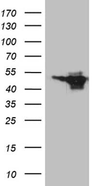HEK293T cells were transfected with the pCMV6-ENTRY control (Left lane) or pCMV6-ENTRY MEIS1 (, Right lane) cDNA for 48 hrs and lysed. Equivalent amounts of cell lysates (5 ug per lane) were separated by SDS-PAGE and immunoblotted with anti-MEIS1 (1:2000).