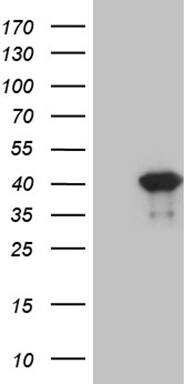 HEK293T cells were transfected with the pCMV6-ENTRY control ( Left lane) or pCMV6-ENTRY PITX2 ( Right lane) cDNA for 48 hrs and lysed. Equivalent amounts of cell lysates (5 ug per lane) were separated by SDS-PAGE and immunoblotted with anti-PITX2 (1:2000). Positive lysates