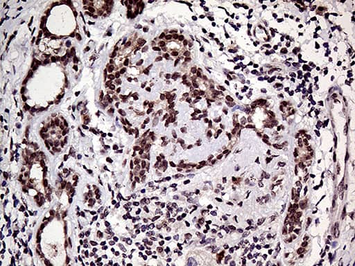 Immunohistochemistry HOXD9 Antibody (OTI1H3)