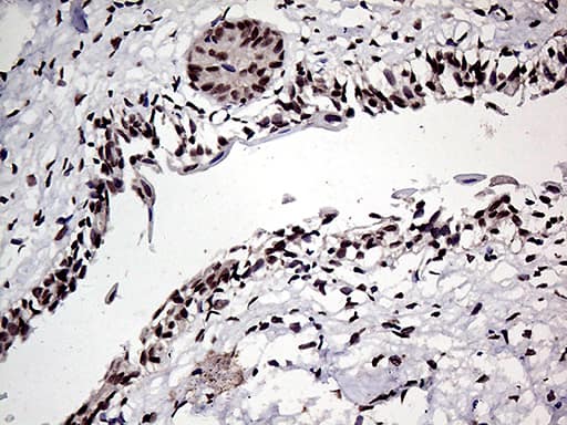 Immunohistochemical staining of paraffin-embedded Human bladder tissue within the normal limits using anti-HOXD9 mouse monoclonal antibody. Heat-induced epitope retrieval by EDTA solution buffer pH 8.0 at 120Â°C for 3 min.