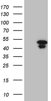 Western Blot HOXD9 Antibody (OTI1H3)