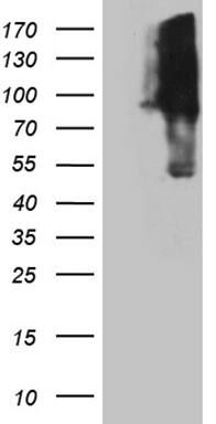 Western Blot KIF9 Antibody (OTI1A2)
