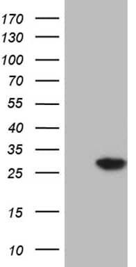 HEK293T cells were transfected with the pCMV6-ENTRY control ( Left lane) or pCMV6-ENTRY NUDT4 ( Right lane) cDNA for 48 hrs and lysed. Equivalent amounts of cell lysates (5 ug per lane) were separated by SDS-PAGE and immunoblotted with anti-NUDT4 (1:2000). Positive lysates
