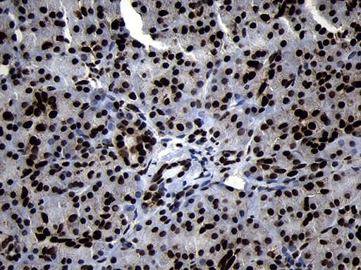 Immunohistochemistry HOXC4 Antibody (OTI1F6)