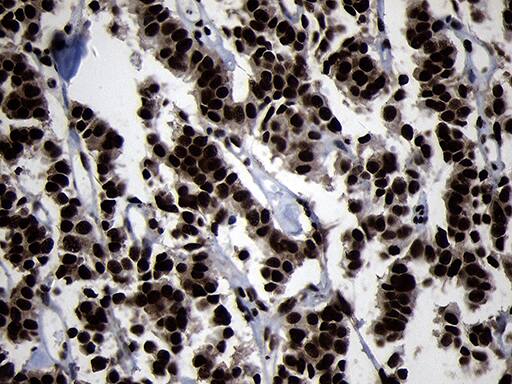 Immunohistochemistry:HOXC4 Antibody (OTI1F6)[NBP3-45006]