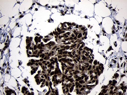 Immunohistochemistry:HOXC4 Antibody (OTI1F6)[NBP3-45006]
