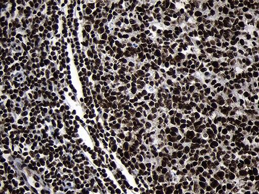 Immunohistochemistry HOXC4 Antibody (OTI1F6)