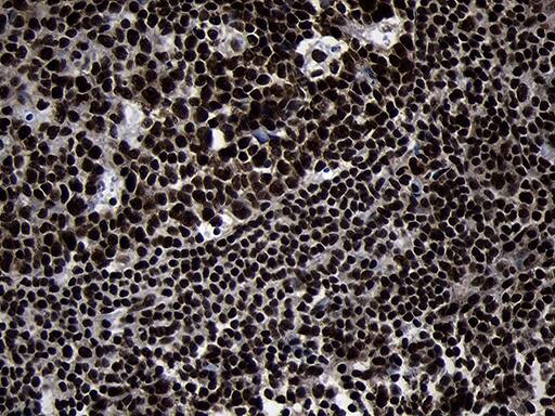Immunohistochemistry HOXC4 Antibody (OTI1F6)