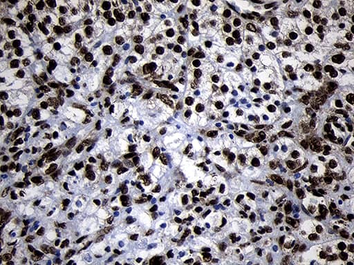 Immunohistochemistry HOXC4 Antibody (OTI1F6)