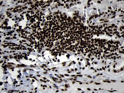 Immunohistochemistry HOXC4 Antibody (OTI1F6)