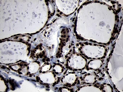 Immunohistochemistry HOXC4 Antibody (OTI1F6)