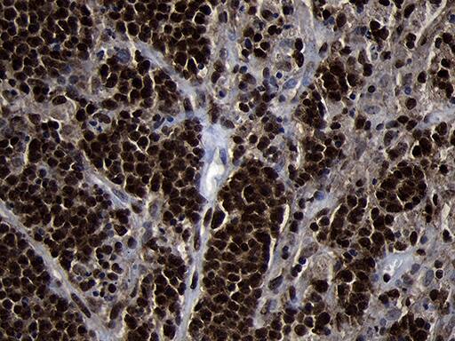 Immunohistochemistry HOXC4 Antibody (OTI1F6)