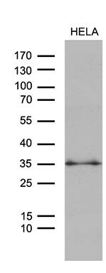 Western blot analysis of extracts (35ug) from HELA cell line by using anti-ZMAT4 monoclonal antibody (1:500).
