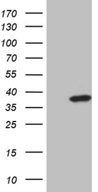HEK293T cells were transfected with the pCMV6-ENTRY control ( Left lane) or pCMV6-ENTRY ZMAT4 ( Right lane) cDNA for 48 hrs and lysed. Equivalent amounts of cell lysates (5 ug per lane) were separated by SDS-PAGE and immunoblotted with anti-ZMAT4 (1:2000). Positive lysates
