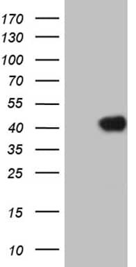 HEK293T cells were transfected with the pCMV6-ENTRY control (Left lane) or pCMV6-ENTRY HOXC4 (, Right lane) cDNA for 48 hrs and lysed. Equivalent amounts of cell lysates (5 ug per lane) were separated by SDS-PAGE and immunoblotted with anti-HOXC4 (1:2000). 