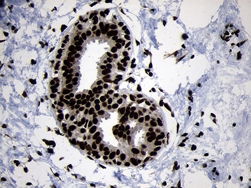 Immunohistochemical staining of paraffin-embedded Human breast tissue within the normal limits using anti-HOXC4 mouse monoclonal antibody. Heat-induced epitope retrieval by EDTA solution buffer pH 8.0 at 120Â°C for 3 min.