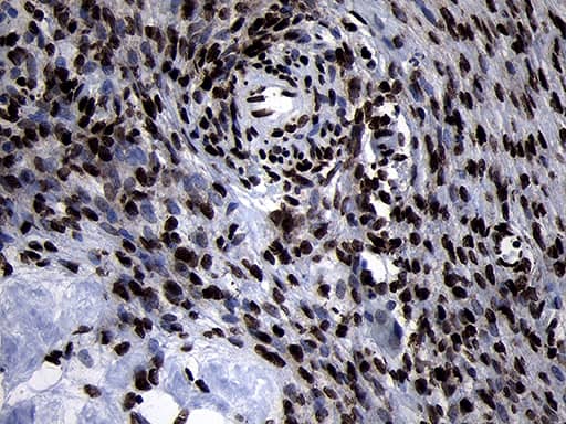 Immunohistochemical staining of paraffin-embedded Human Ovary tissue within the normal limits using anti-HOXC4 mouse monoclonal antibody. Heat-induced epitope retrieval by EDTA solution buffer pH 8.0 at 120Â°C for 3 min.
