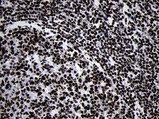 Immunohistochemical staining of paraffin-embedded Human lymph node tissue within the normal limits using anti-HOXC4 mouse monoclonal antibody. Heat-induced epitope retrieval by EDTA solution buffer pH 8.0 at 120Â°C for 3 min.