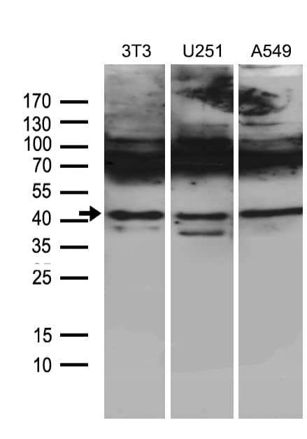 Western blot analysis of extracts (35ug) from 3 different cell lines by using anti-HOXC4 monoclonal antibody (1:500).