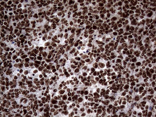 Immunohistochemistry SH3BGRL Antibody (OTI8F7)