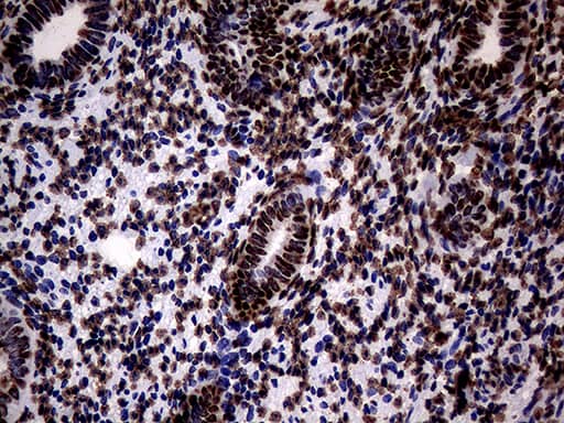 Immunohistochemical staining of paraffin-embedded Human endometrium tissue within the normal limits using anti-SH3BGRL mouse monoclonal antibody. Heat-induced epitope retrieval by EDTA solution buffer pH 8.0 at 120Â°C for 3 min.