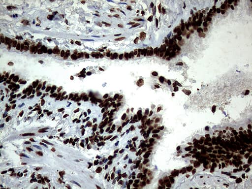 Immunohistochemical staining of paraffin-embedded Human lung tissue within the normal limits using anti-SH3BGRL mouse monoclonal antibody. Heat-induced epitope retrieval by EDTA solution buffer pH 8.0 at 120Â°C for 3 min.