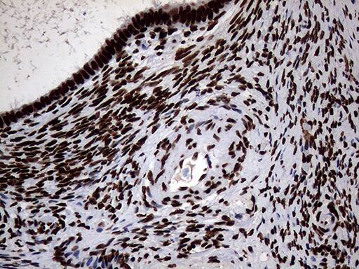 Immunohistochemical staining of paraffin-embedded Human Ovary tissue within the normal limits using anti-SH3BGRL mouse monoclonal antibody. Heat-induced epitope retrieval by EDTA solution buffer pH 8.0 at 120Â°C for 3 min.