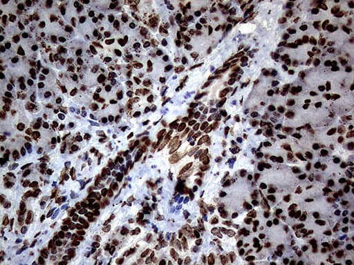 Immunohistochemical staining of paraffin-embedded Human pancreas tissue within the normal limits using anti-SH3BGRL mouse monoclonal antibody. Heat-induced epitope retrieval by EDTA solution buffer pH 8.0 at 120Â°C for 3 min.