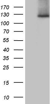 Western Blot SUPT16H Antibody (OTI3B8)