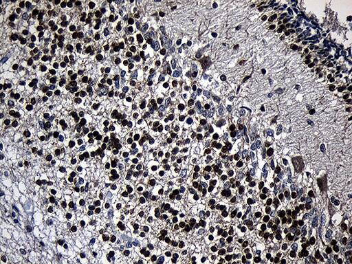 Immunohistochemical staining of paraffin-embedded Human embryonic cerebellum within the normal limits using anti-PHF20L1 mouse monoclonal antibody. Heat-induced epitope retrieval by EDTA solution buffer pH 8.0 at 120Â°C for 3 min.